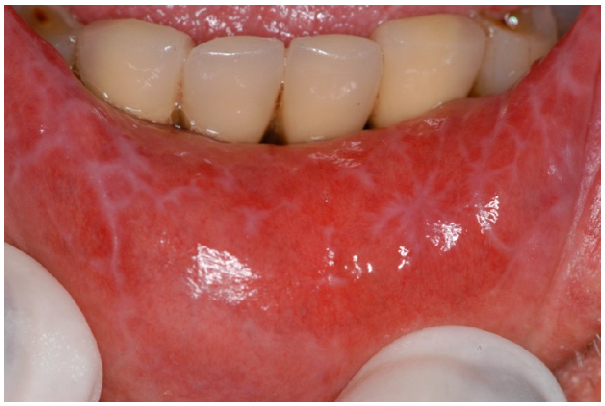 Ijms 25 04373 g005 Ijms 25 04373 g005