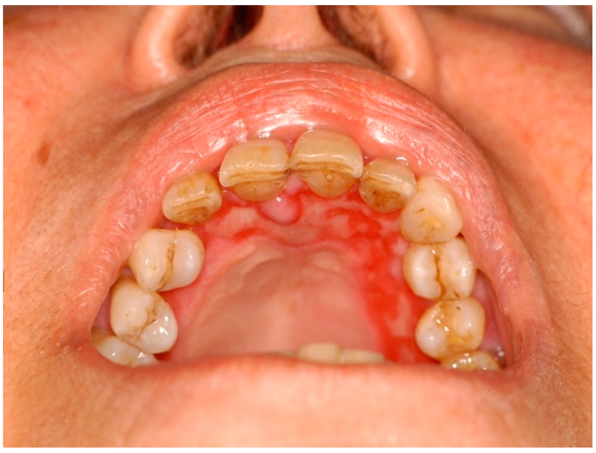 Ijms 25 04373 g006 Ijms 25 04373 g006