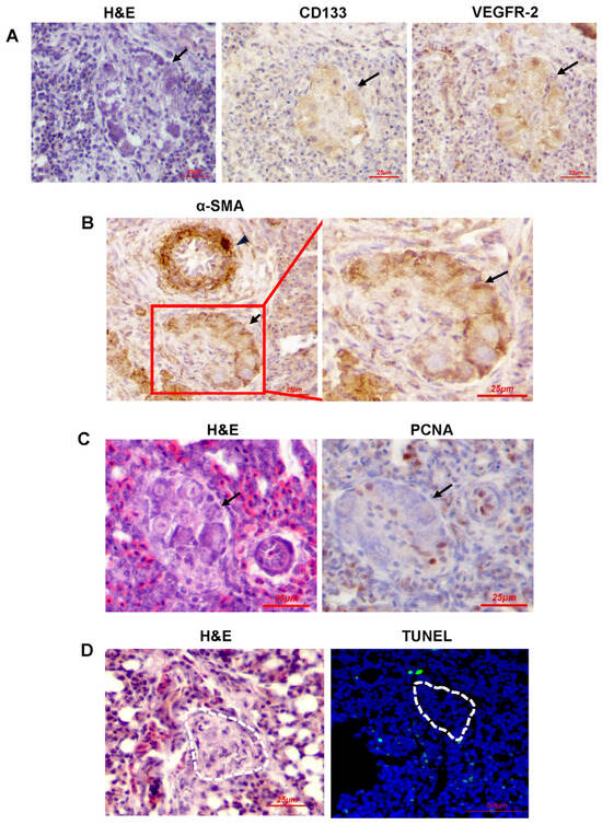 Dysregulated VEGF/VEGFR-2 Signaling and Plexogenic Lesions in the ...