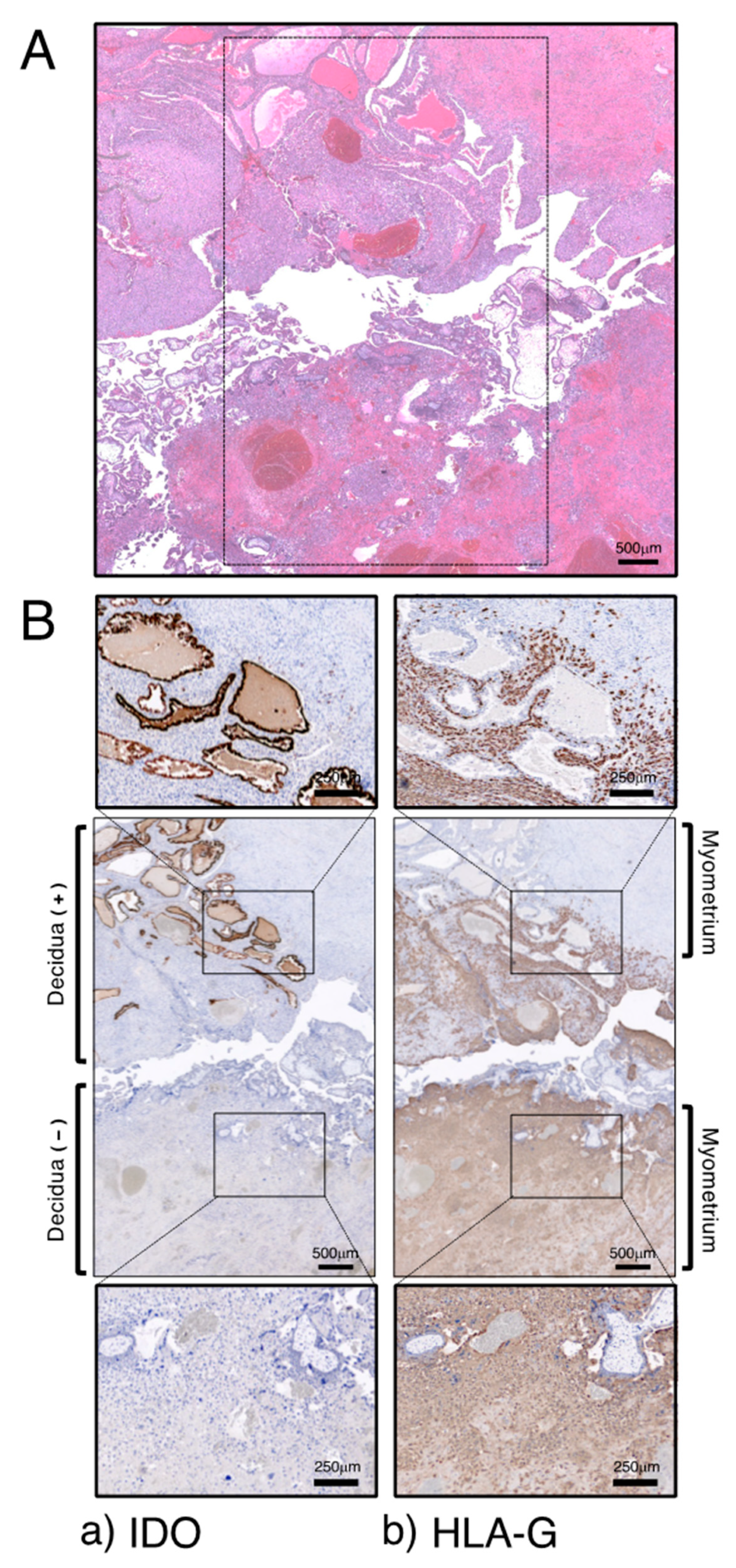 Ijms 25 04577 g004 Ijms 25 04577 g004