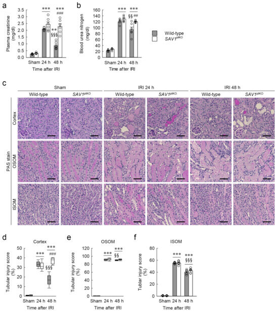 その他 aki Progress and Challenges of Understanding Cardiorenal