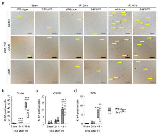 Loss of SAV1 in Kidney Proximal Tubule Induces Maladaptive