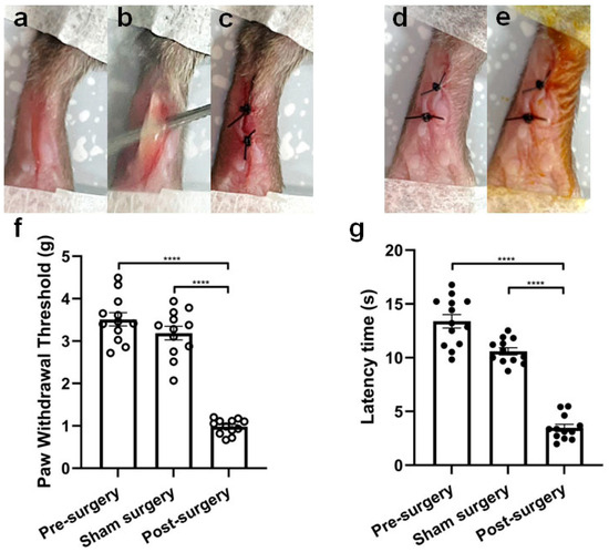 Novel Scorpion Toxin ω-Buthitoxin-Hf1a Selectively Inhibits