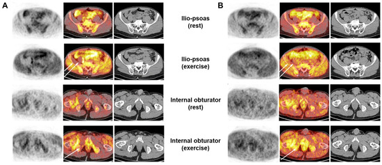 Radiopharmaceuticals for Skeletal Muscle PET Imaging