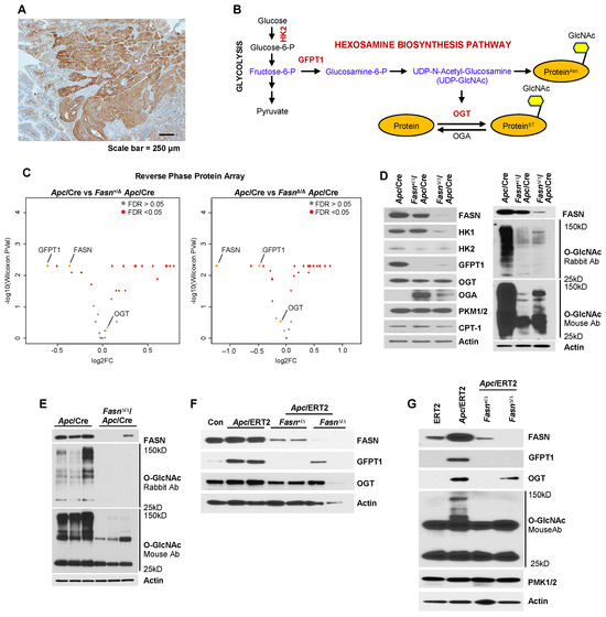 Overexpression of Fatty Acid Synthase Upregulates Glutamine
