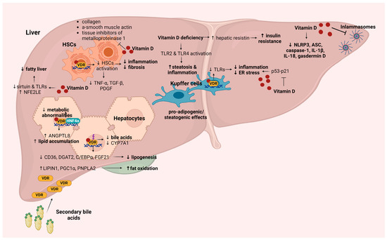 Vitamin D and Metabolic Dysfunction-Associated Steatotic