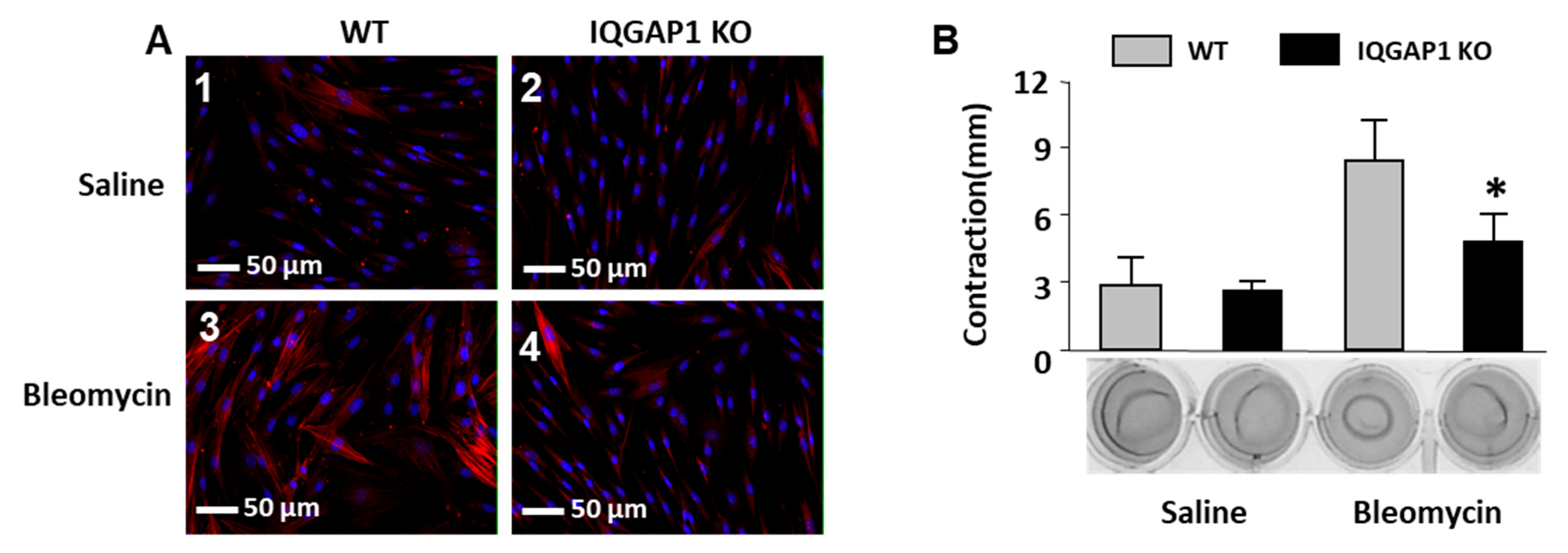 Ijms 25 05244 g005 Ijms 25 05244 g005