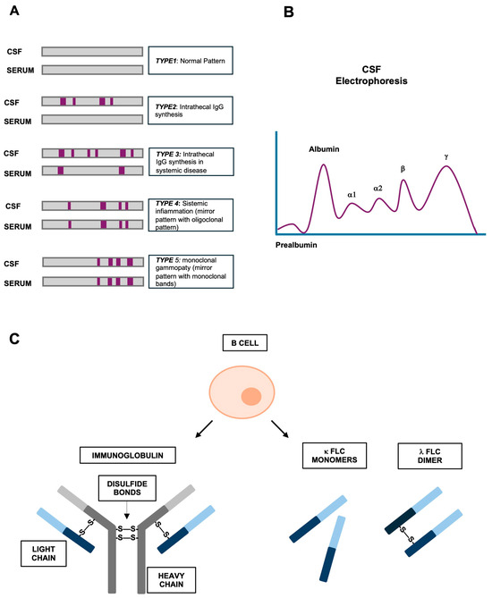 Multiple Sclerosis: From the Application of Oligoclonal