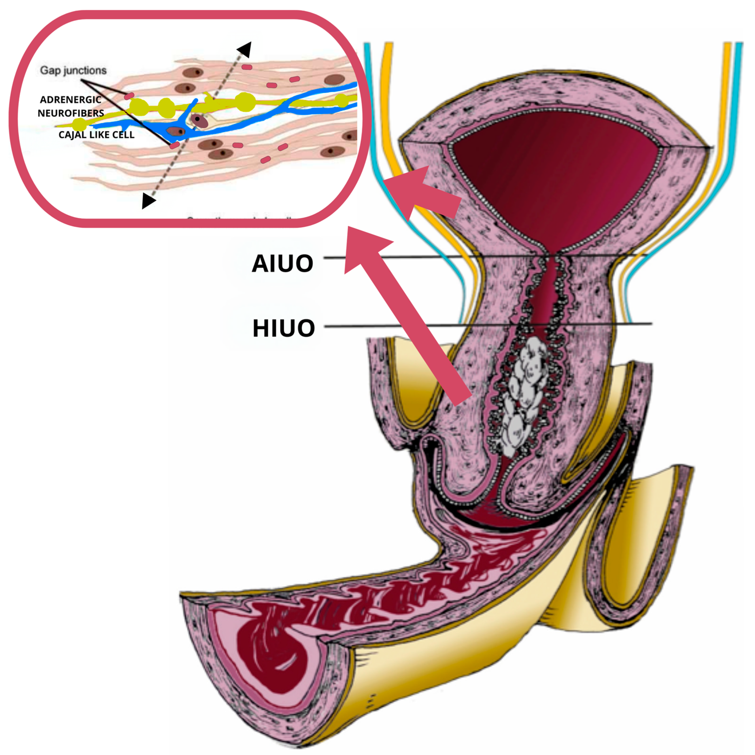 Localization of Catecholaminergic Neurofibers in Pregnant Cervix 
