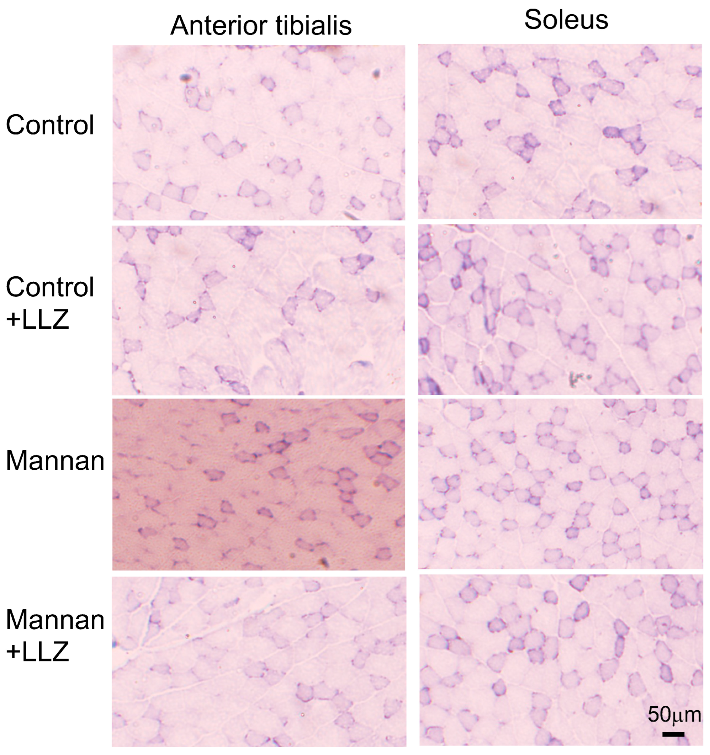 Ijms 25 05715 g003 Ijms 25 05715 g003