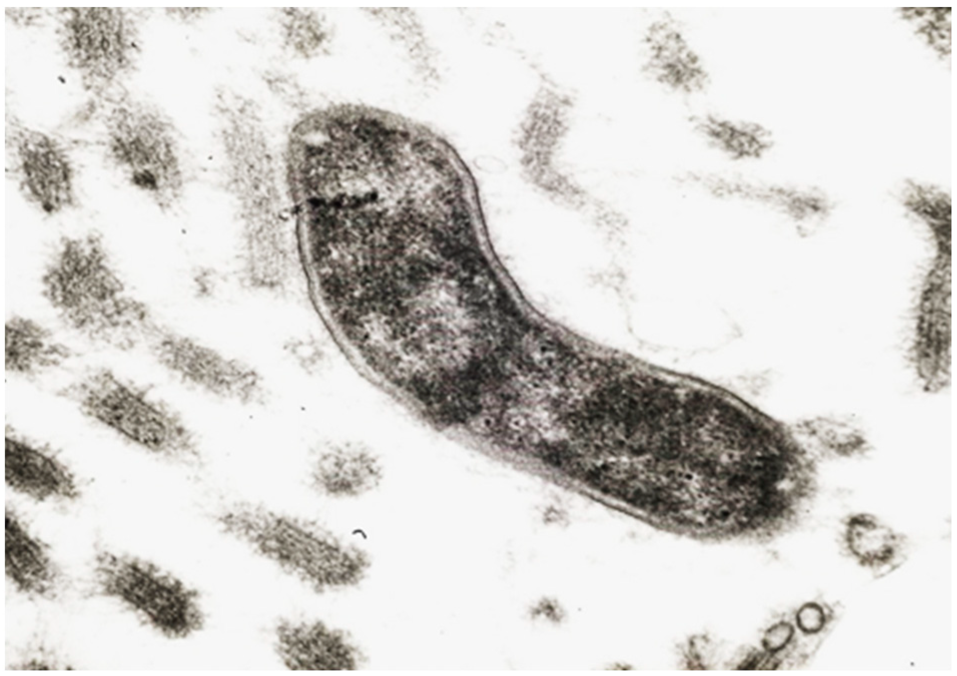 Ijms 25 05856 g002 Ijms 25 05856 g002