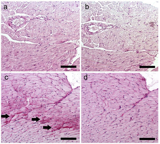 Pathological Changes and Metabolic Adaptation in the Myocardium of Rats ...
