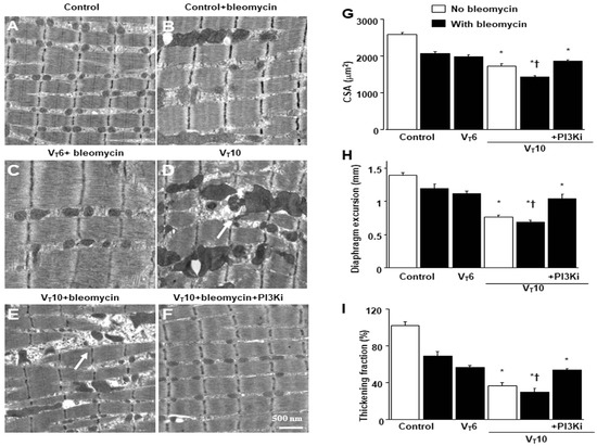Suppression of Ventilation-Induced Diaphragm Fibrosis