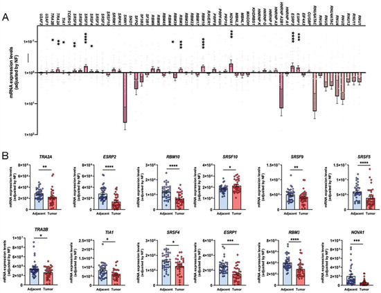 Splicing Machinery Is Impaired in Oral Squamous Cell