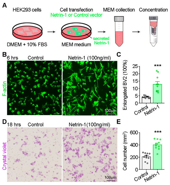 Netrin-1 Is an Important Mediator in Microglia Migration Netrin-1 Is an Important Mediator in Microglia Migration