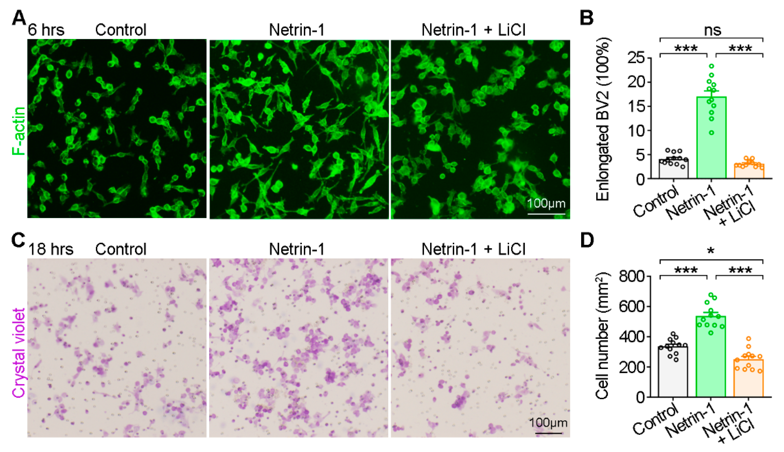 Netrin-1 Is an Important Mediator in Microglia Migration