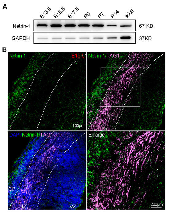Netrin-1 Is an Important Mediator in Microglia Migration
