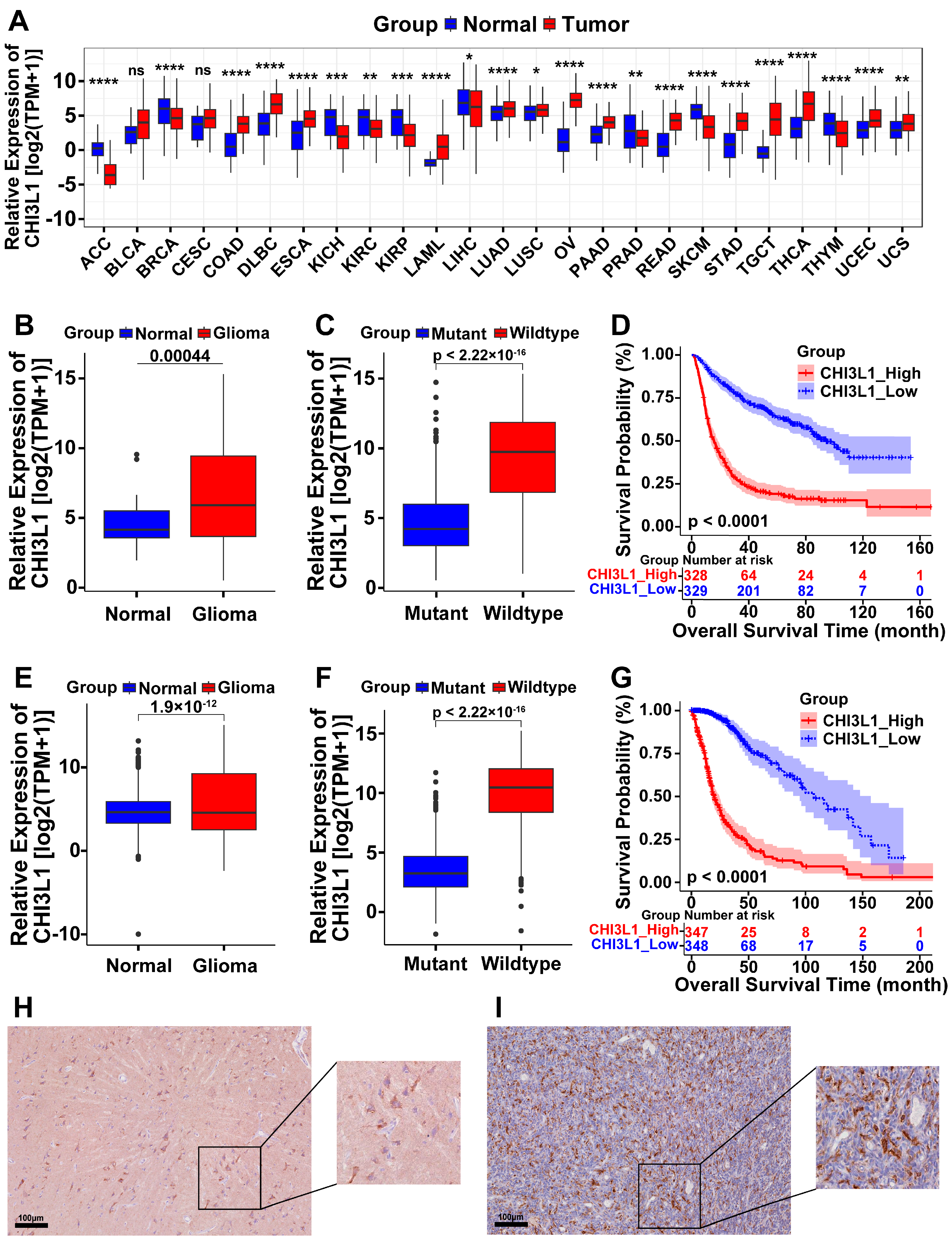 CHI3L1 as a Prognostic Biomarker and Therapeutic Target in