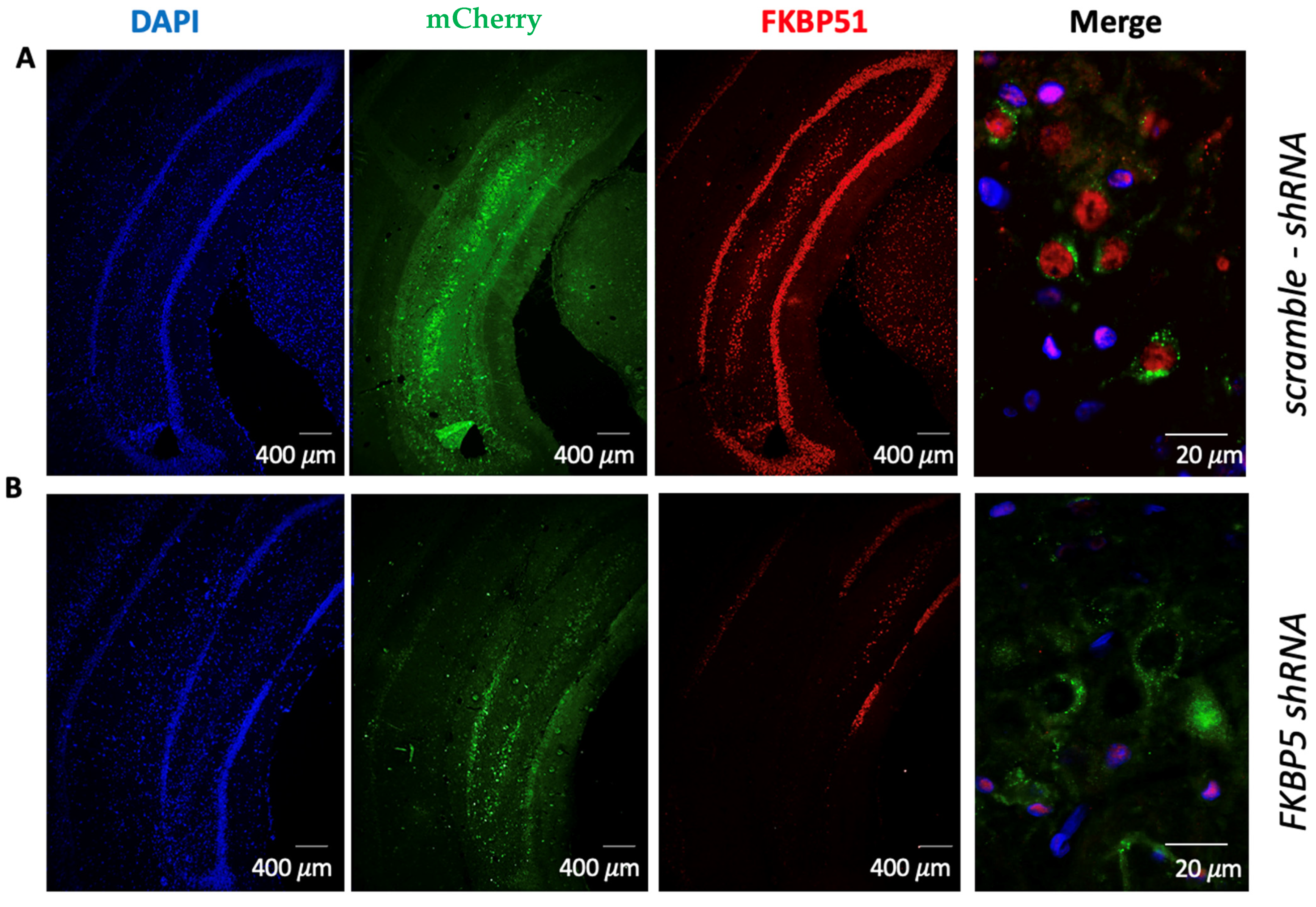 Reducing FKBP51 Expression in the Ventral Hippocampus