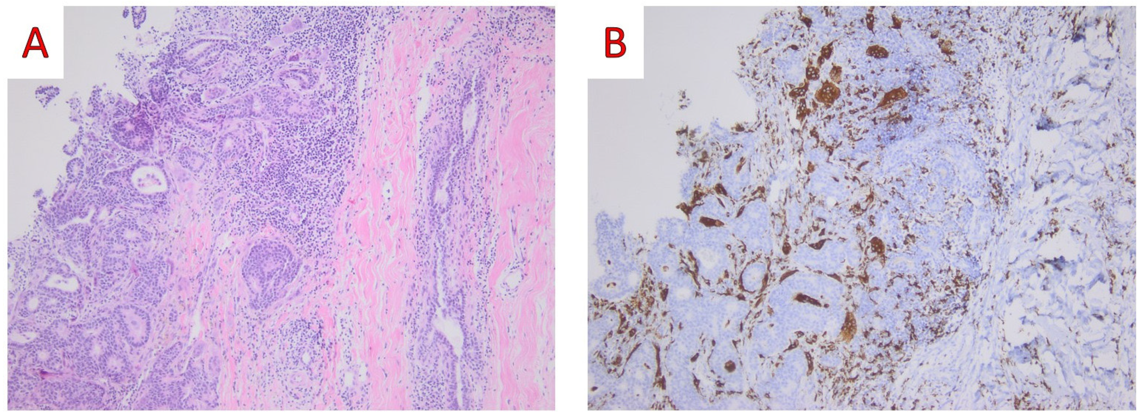 Ijms 25 08382 g006 Ijms 25 08382 g006