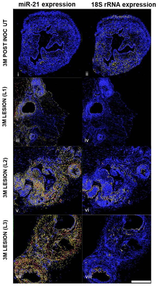 The Regulation of MicroRNA-21 by Interleukin-6 and Its Role in the ...