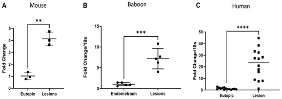 The Regulation of MicroRNA-21 by Interleukin-6 and Its Role in the ...