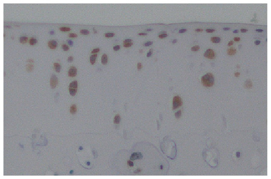 Cartilage Homeostasis under Physioxia