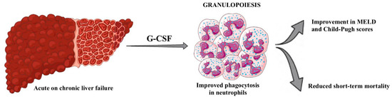 The Impact of Liver Failure on the Immune System