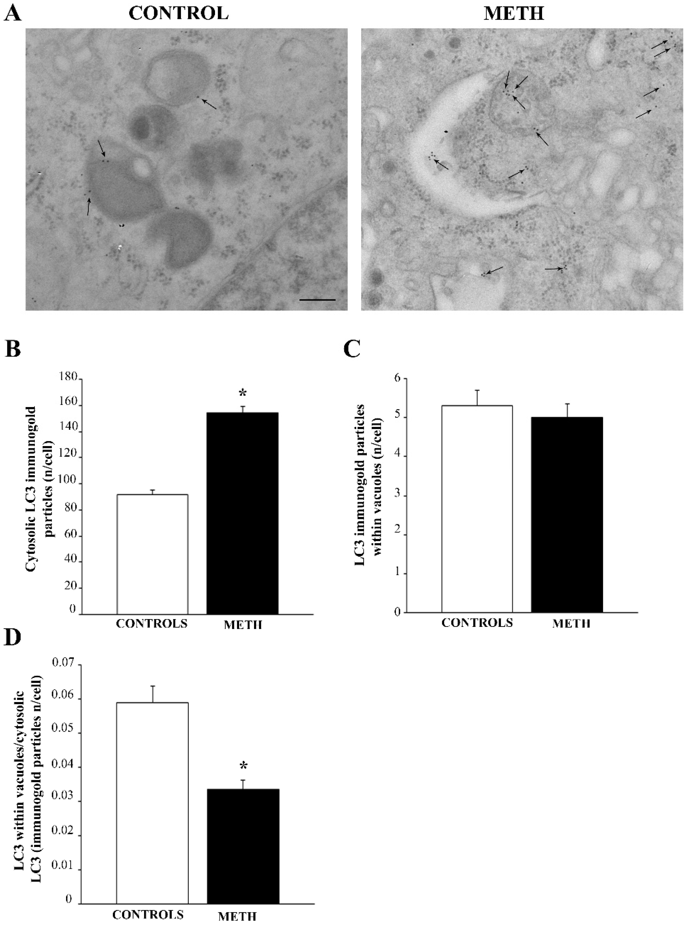 Ijms 25 09601 g004 Ijms 25 09601 g004
