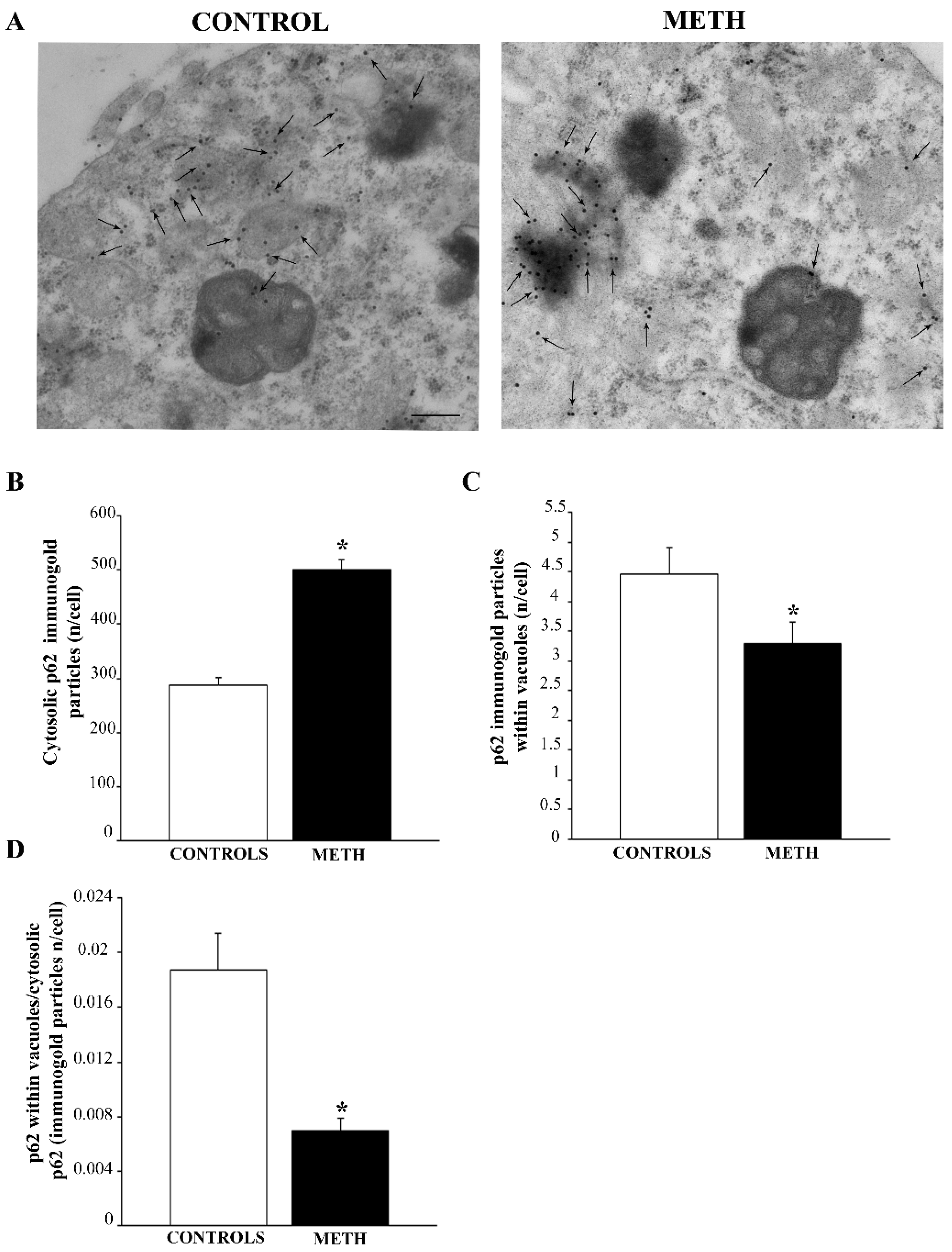 Ijms 25 09601 g005 Ijms 25 09601 g005