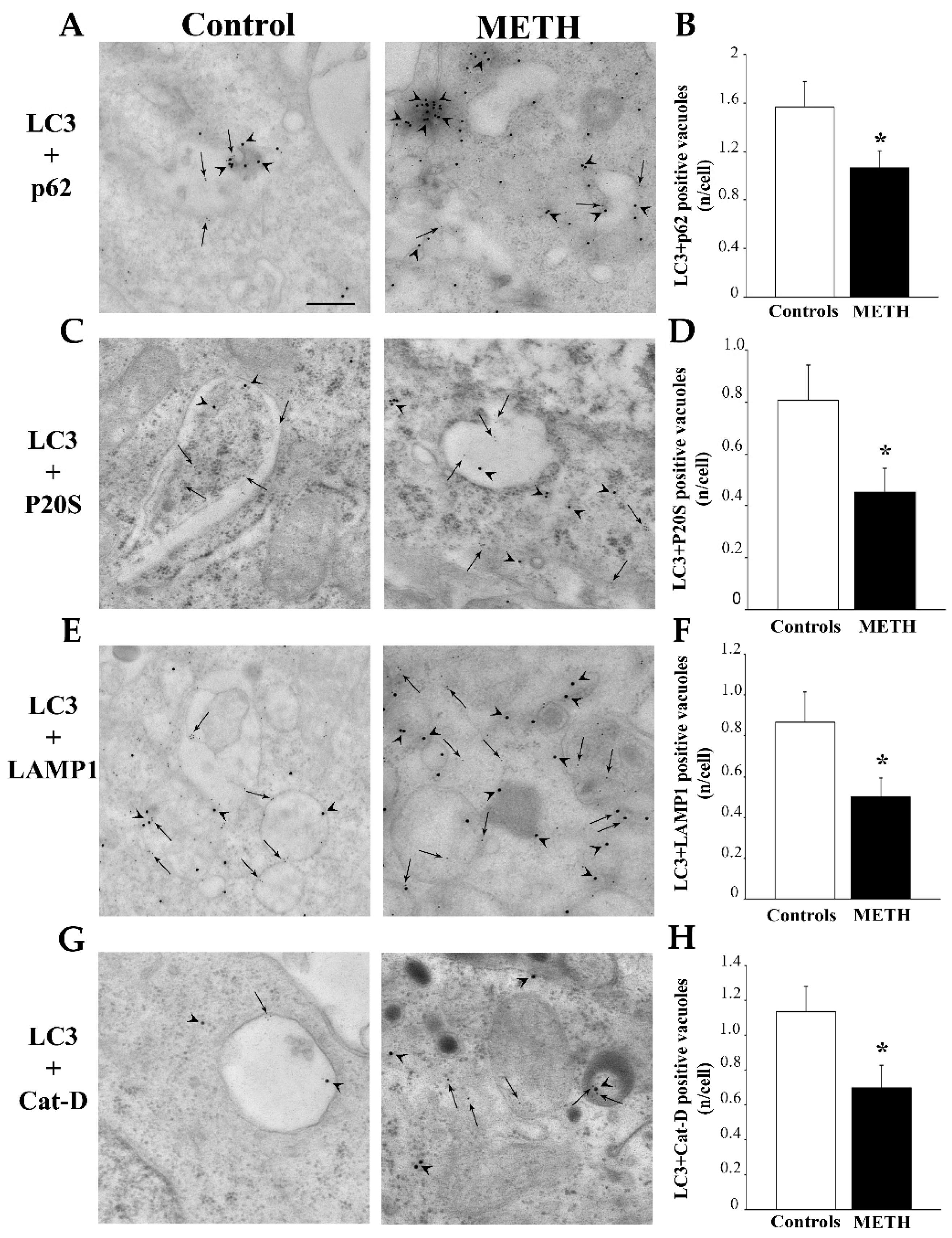 Ijms 25 09601 g009 Ijms 25 09601 g009