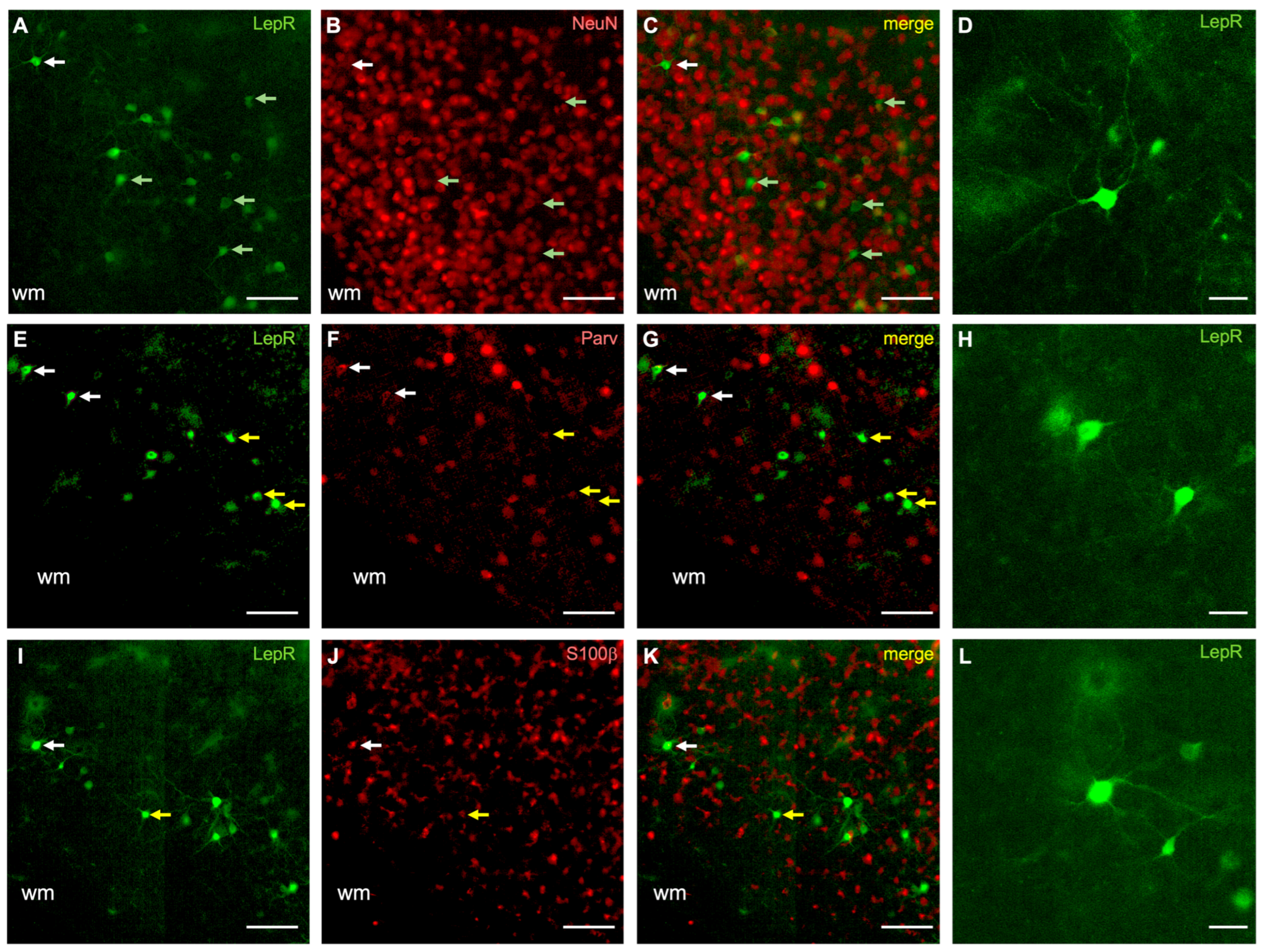 Ijms 25 09854 g002 Ijms 25 09854 g002