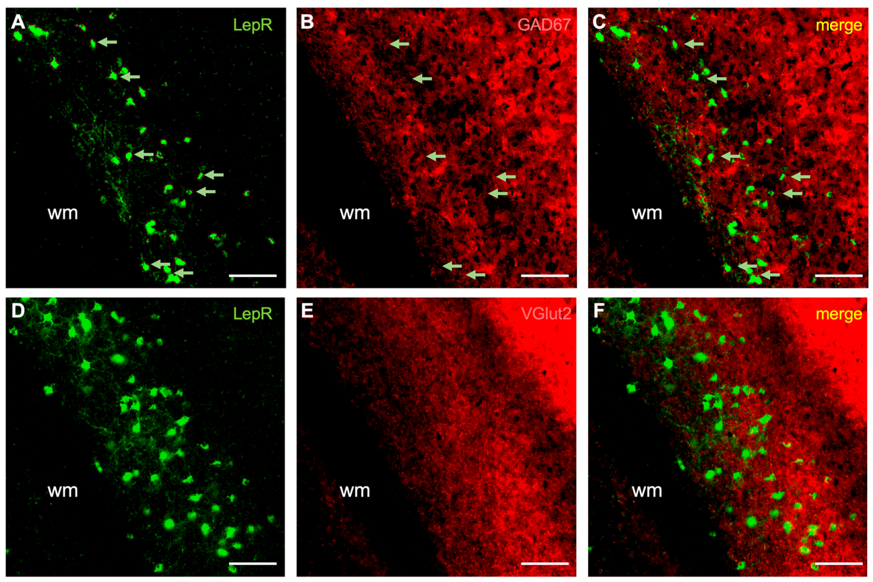 Ijms 25 09854 g003 Ijms 25 09854 g003