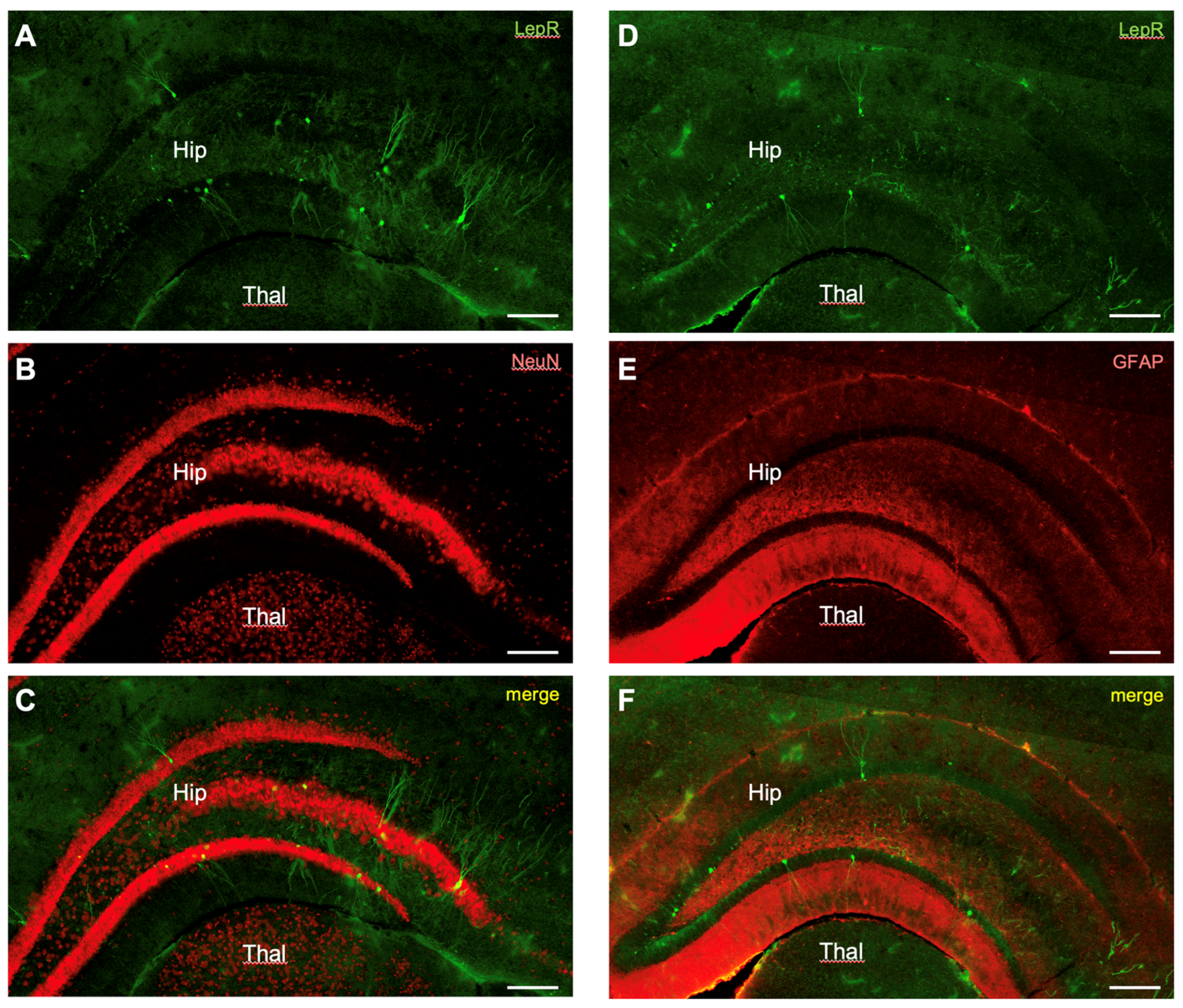 Ijms 25 09854 g005 Ijms 25 09854 g005