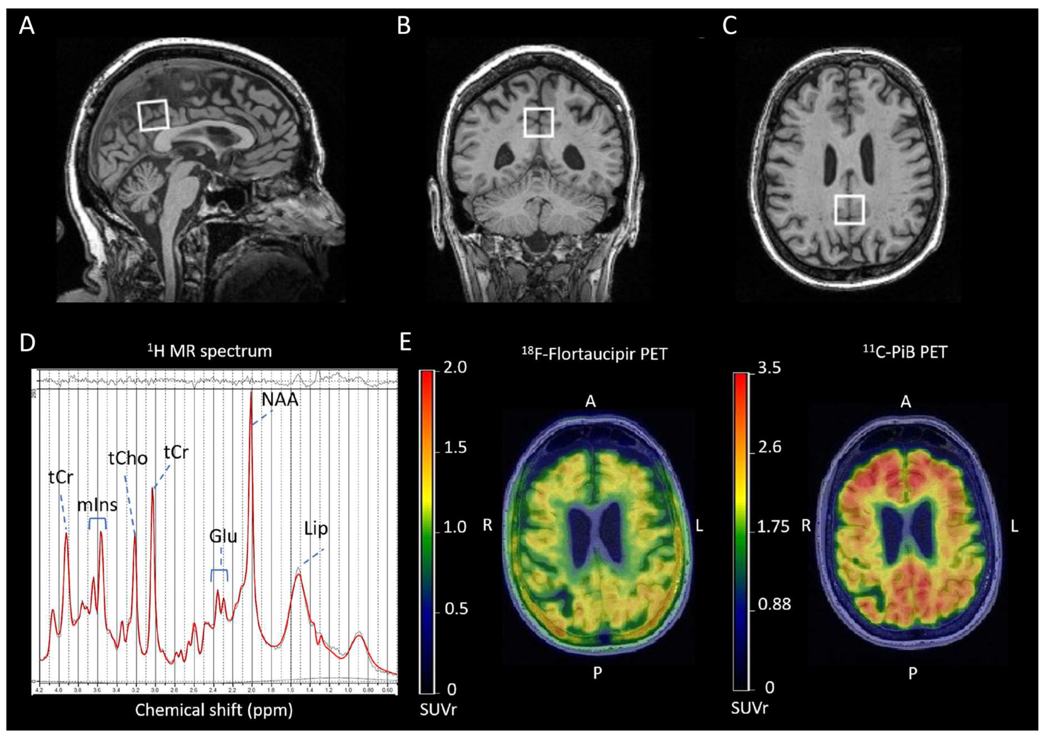 Ijms 25 10064 g002 Ijms 25 10064 g002