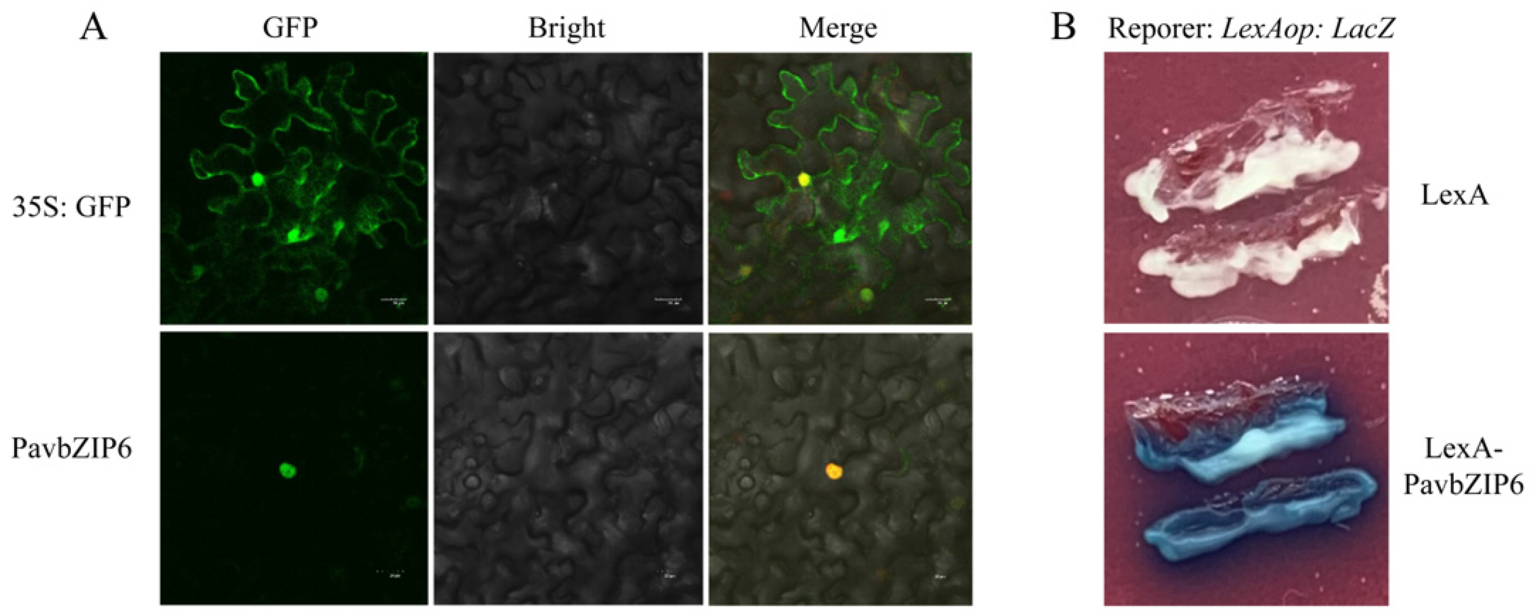 bZIP Transcription Factor PavbZIP6 Regulates Anthocyanin