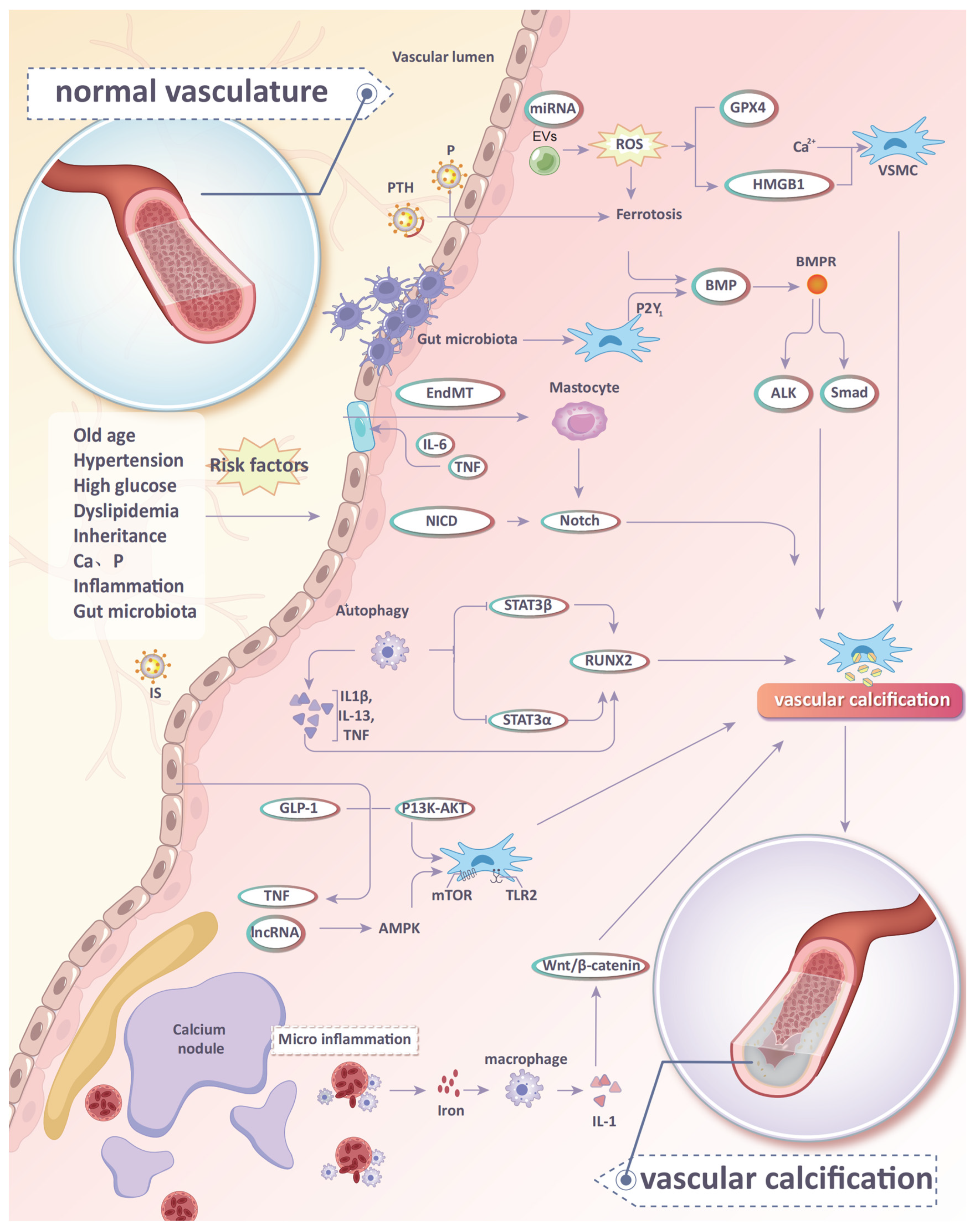 Current Understanding of Cardiovascular Calcification in