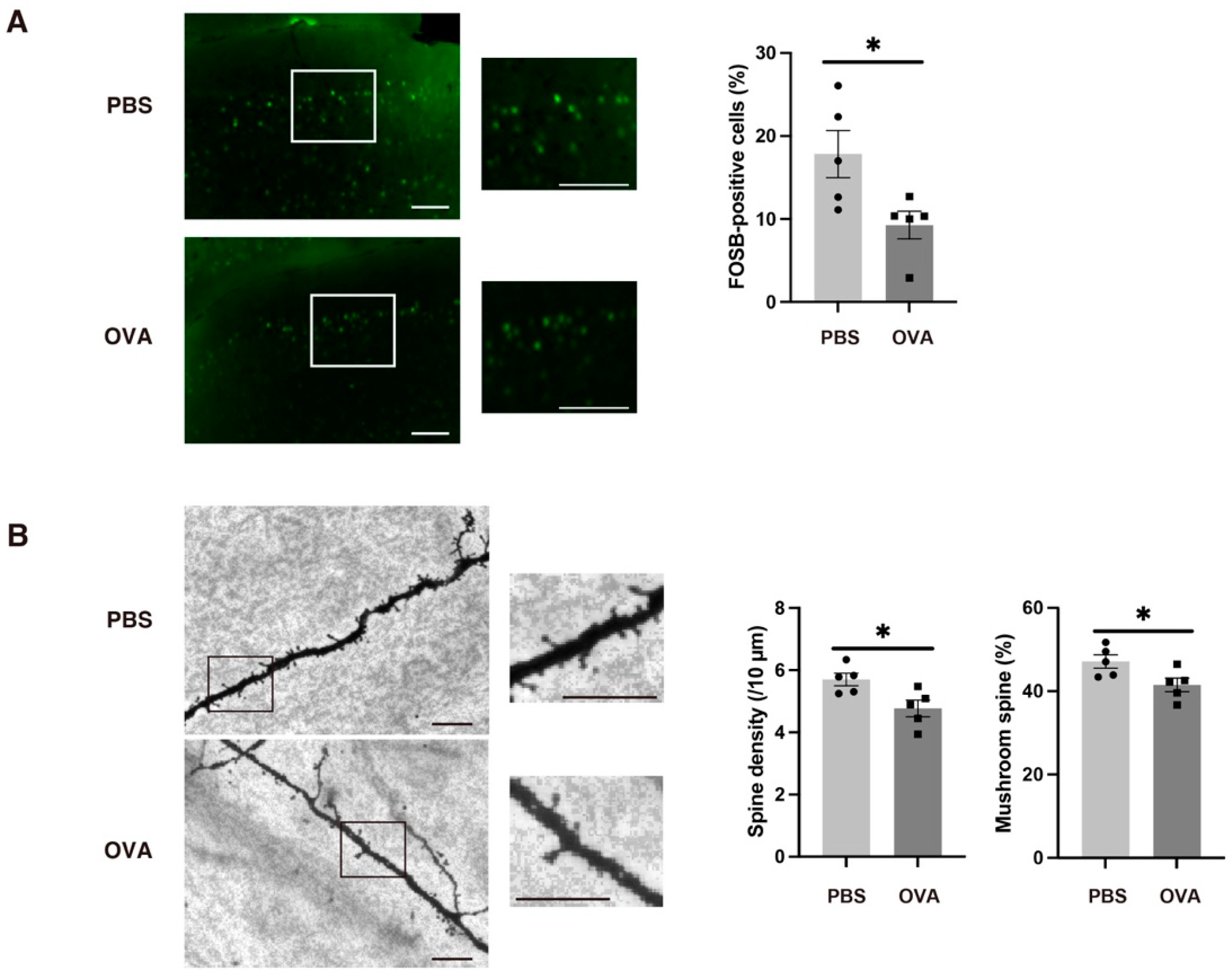 Ijms 25 10464 g006 Ijms 25 10464 g006