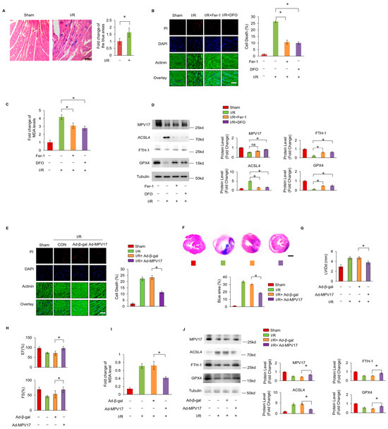 MPV17 Prevents Myocardial Ferroptosis and Ischemic Cardiac Injury