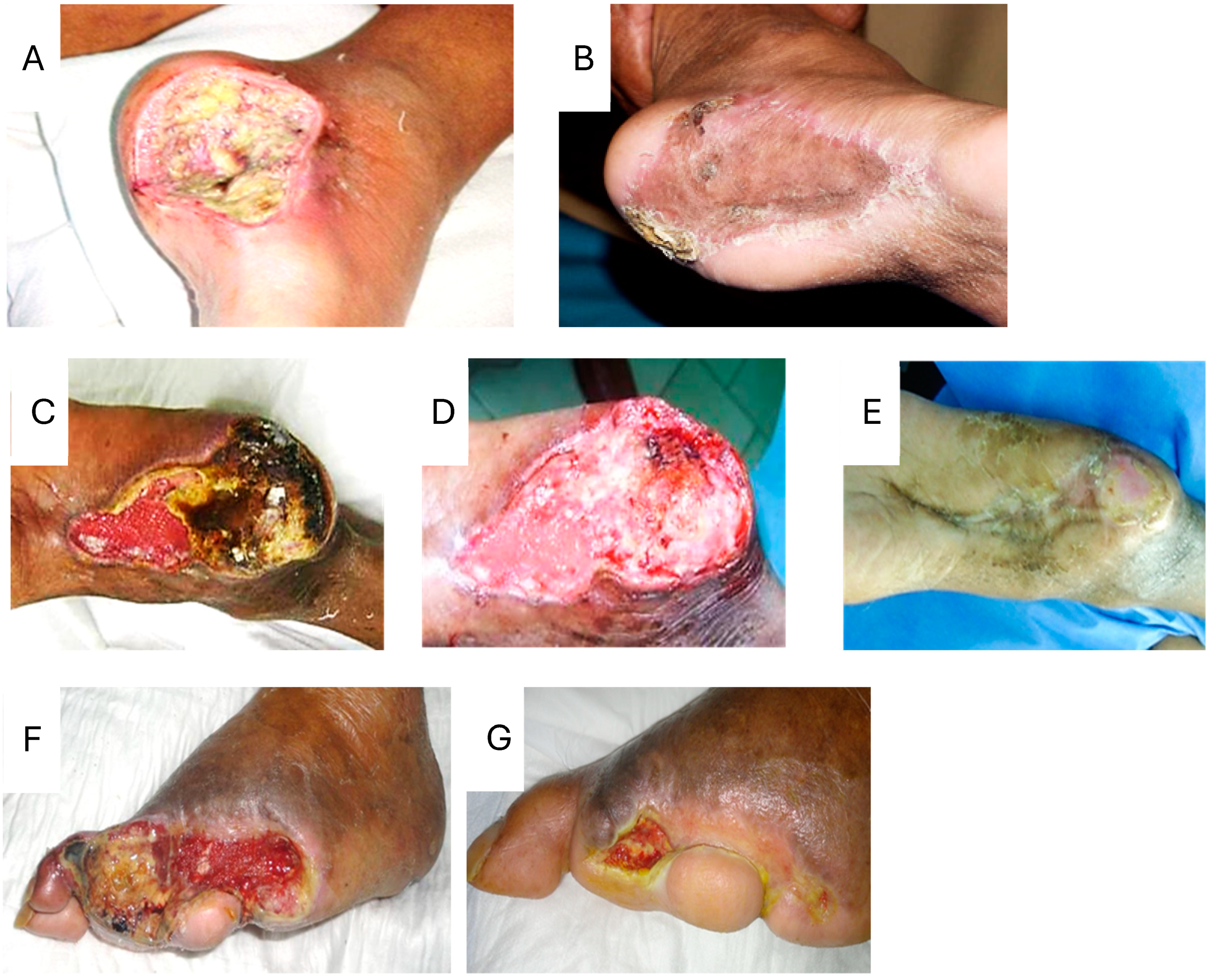 Ijms 25 10883 g005 Ijms 25 10883 g005