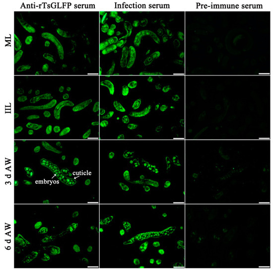 新発売 A the Strengthens Galectin spiralis Trichinella Novel その他