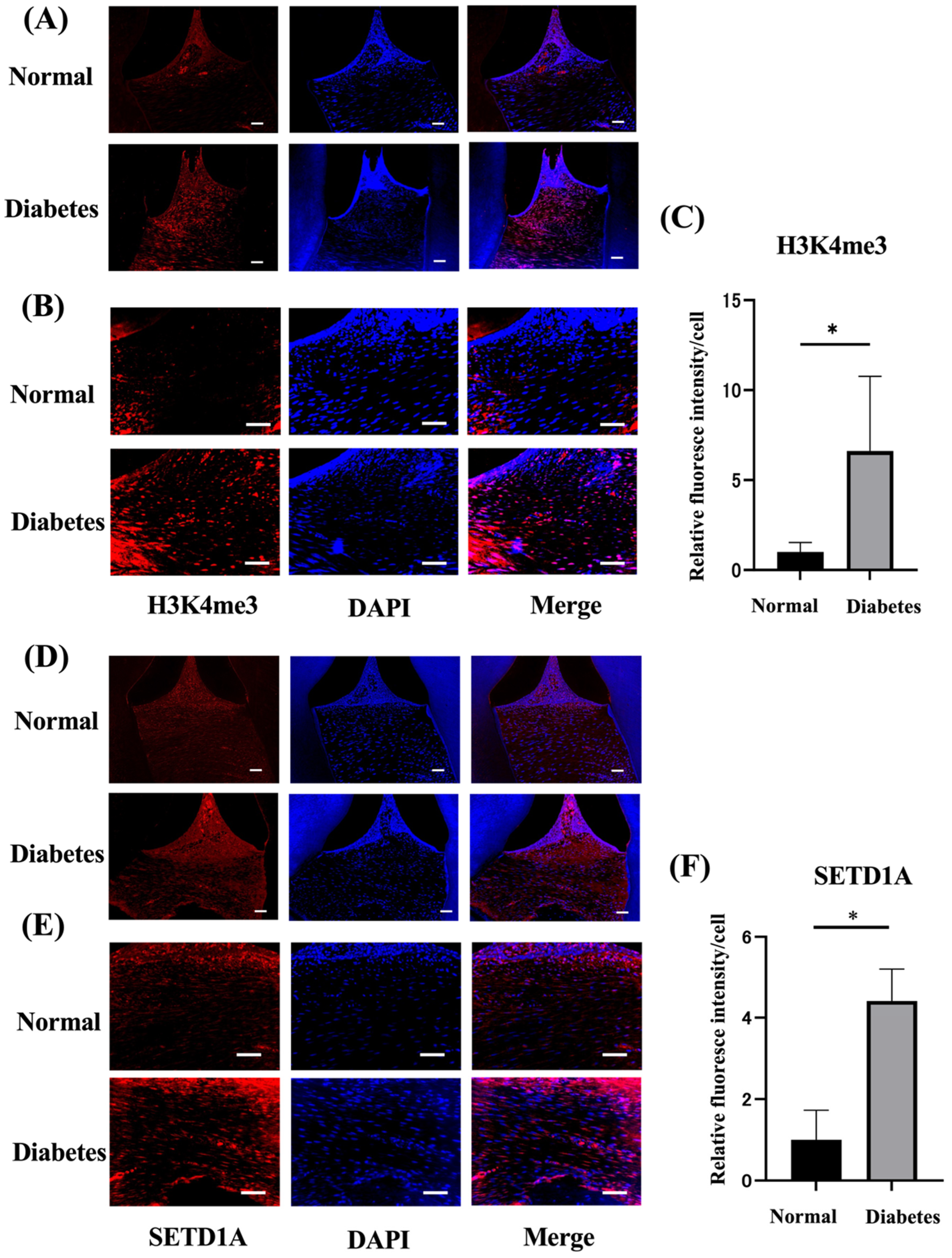 Impacts of Hyperglycemia on Epigenetic Modifications in
