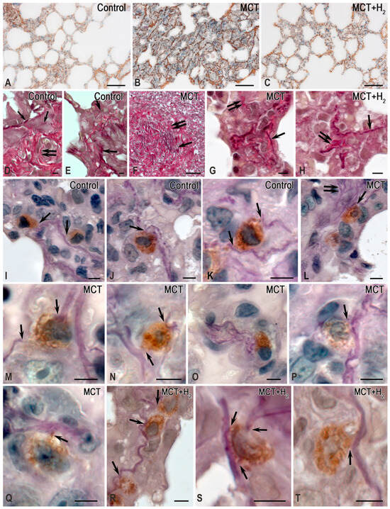 The Role of Mast Cells in the Remodeling Effects of