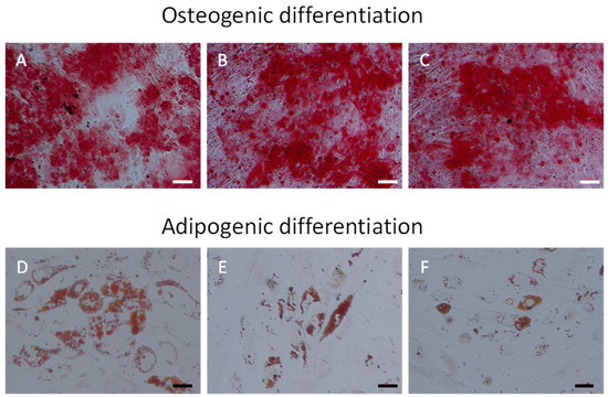 7-Ketocholesterol Effects on Osteogenic Differentiation of Adipose ...