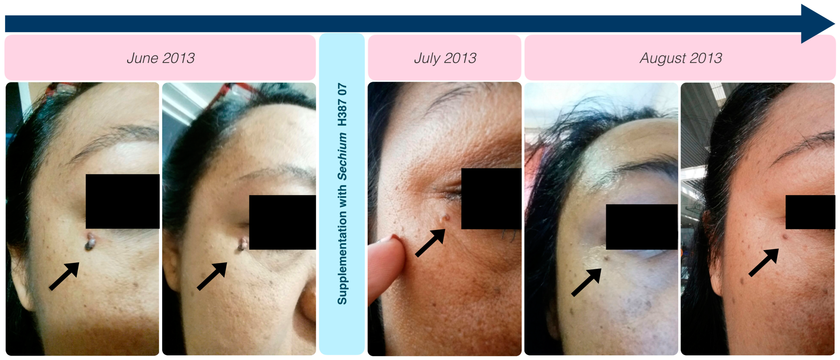 Ijms 25 11477 g005 Ijms 25 11477 g005