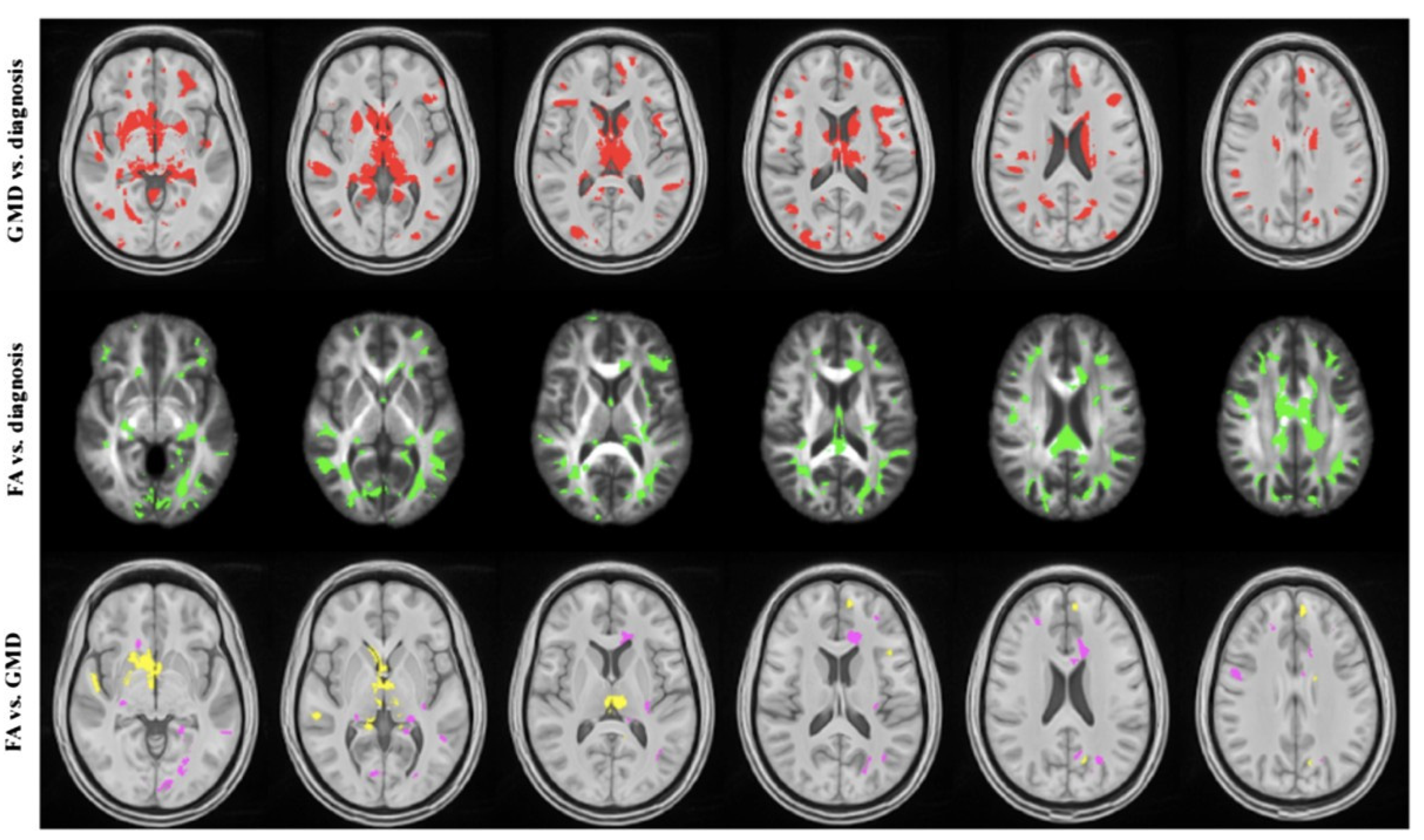 Assessing Mild Traumatic Brain Injury-Associated Blood–Brain