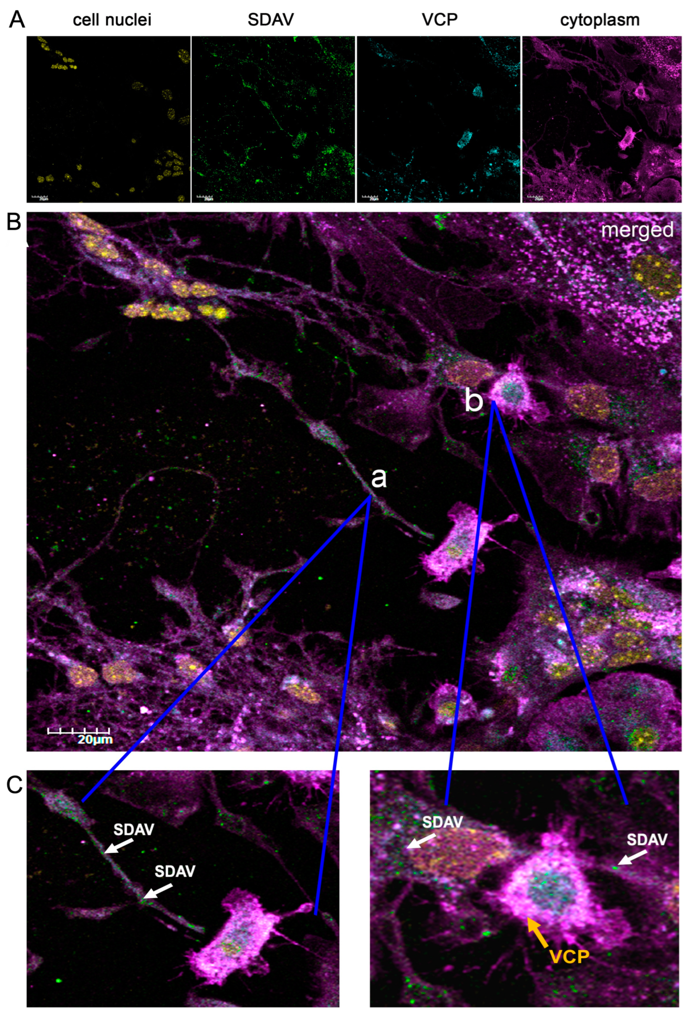 Ijms 25 11633 g004 Ijms 25 11633 g004