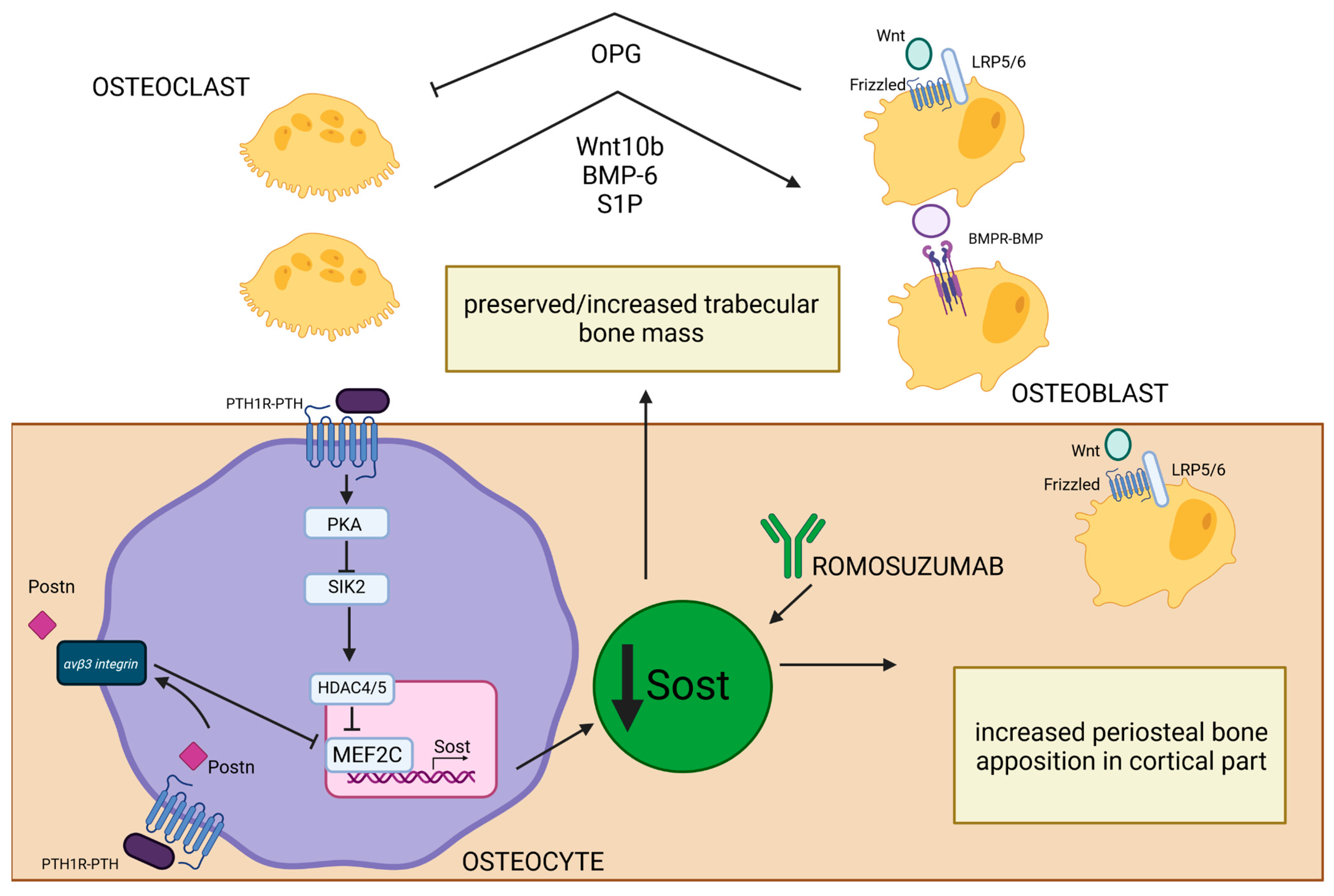 Bone Disease in Primary Hyperparathyroidism—Changes