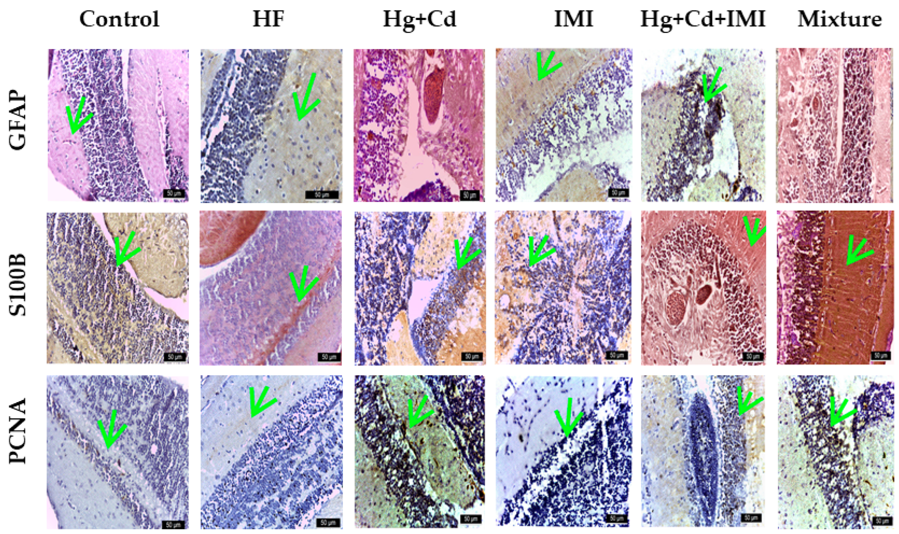 Ijms 25 11730 g005 Ijms 25 11730 g005