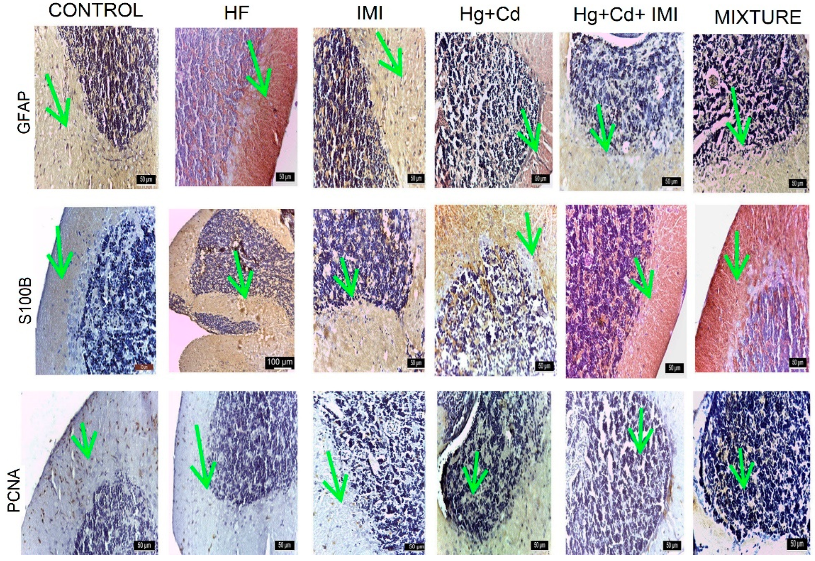 Ijms 25 11730 g006 Ijms 25 11730 g006